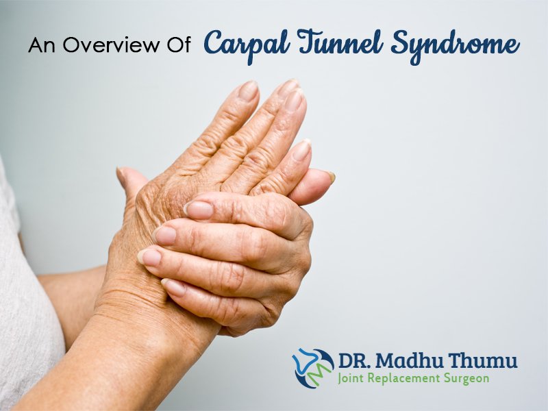 An Overview Of Carpal Tunnel Syndrome