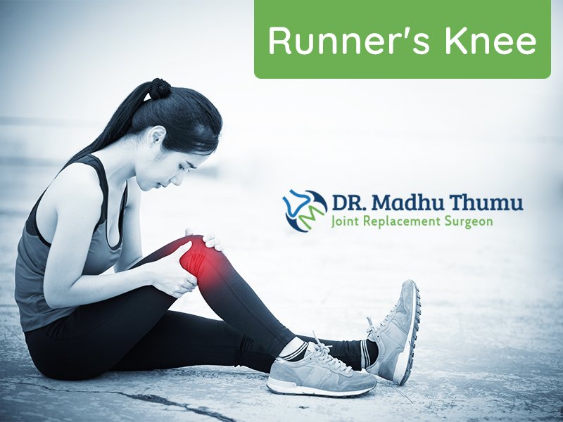 Runner’s Knee – An Overview